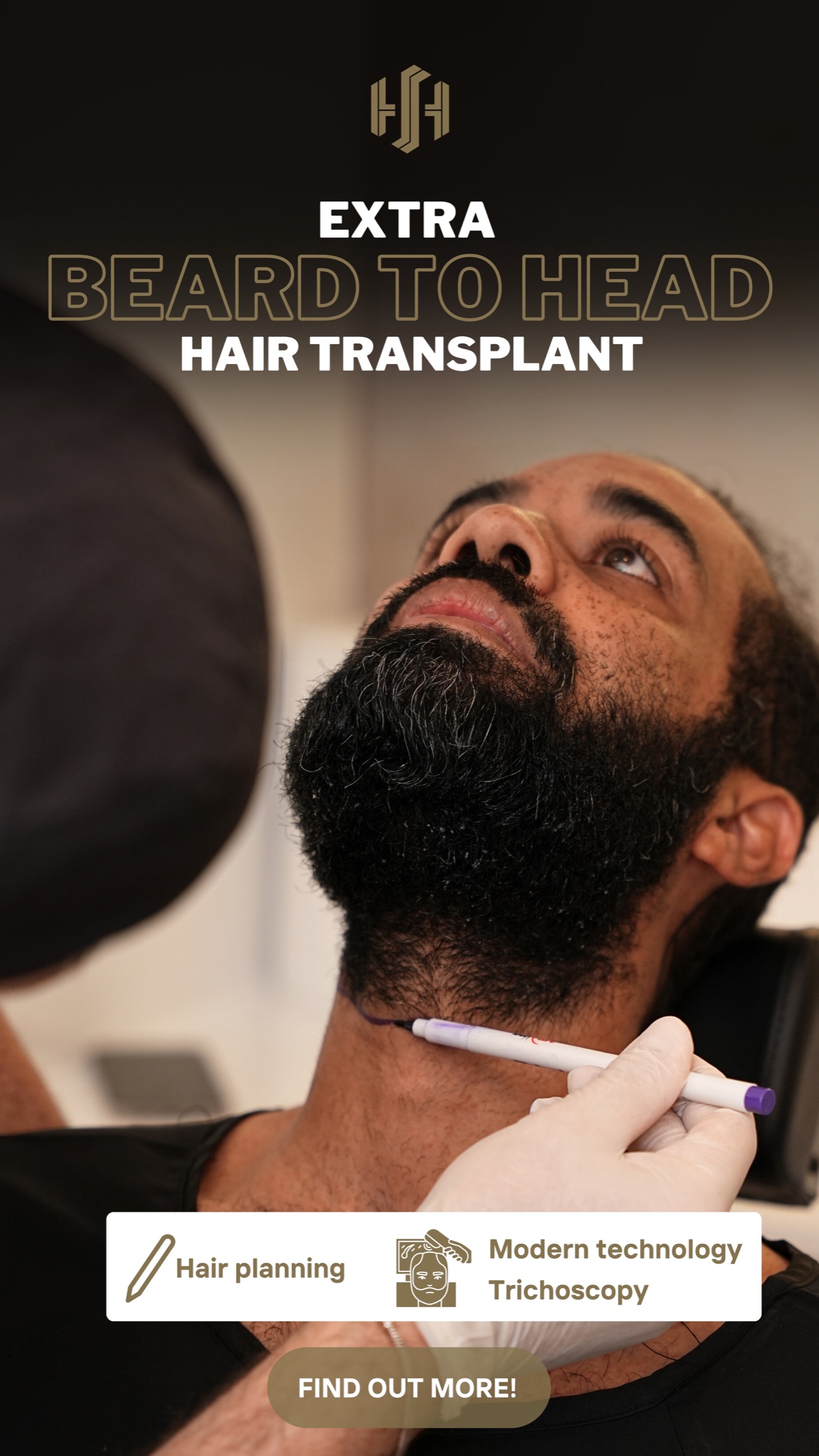 Perencanaan donor janggut untuk transplantasi rambut di Sule Hair Clinic