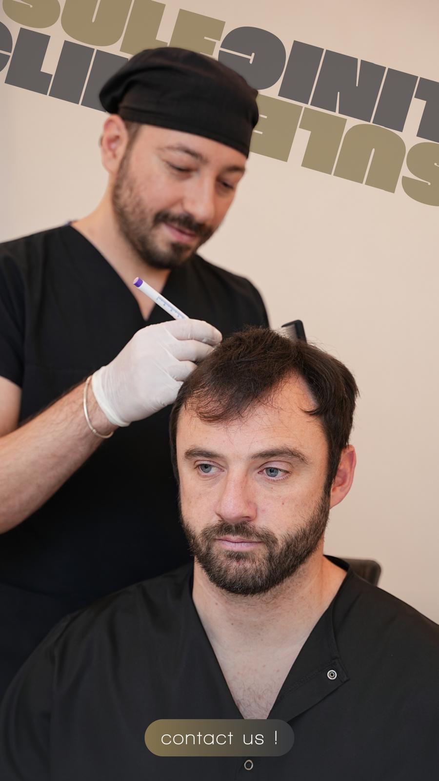 Tim medis Sule Hair Clinic sedang menyiapkan desain hairline pasien